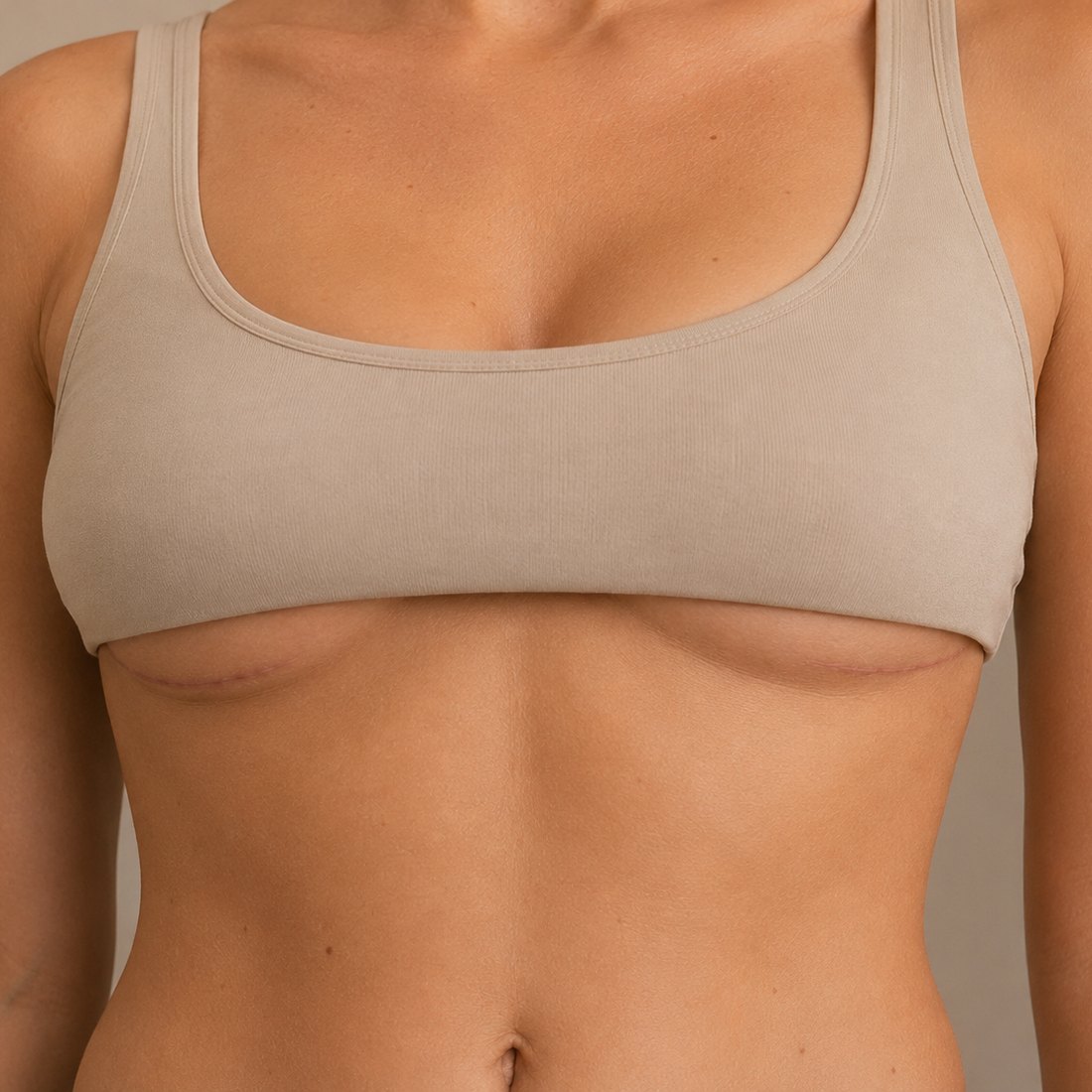 Healed breast lift scars at the breast crease